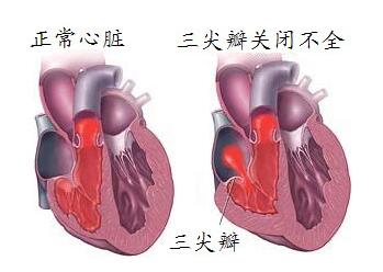 引起人流费用的原因